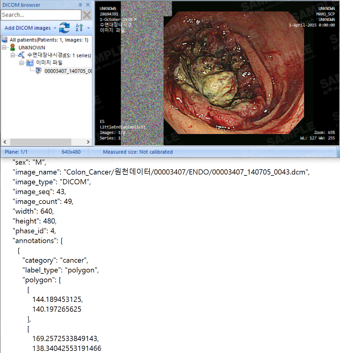 대장암 진단 의료 영상-대표도면