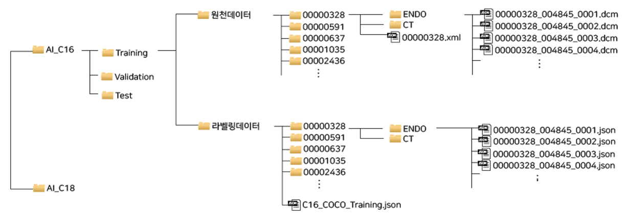대장암 진단 의료 영상-데이터 저장 구조 이미지