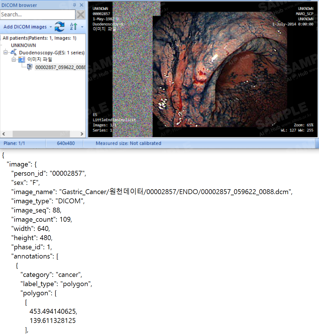 위암 진단 의료 영상-대표도면-1