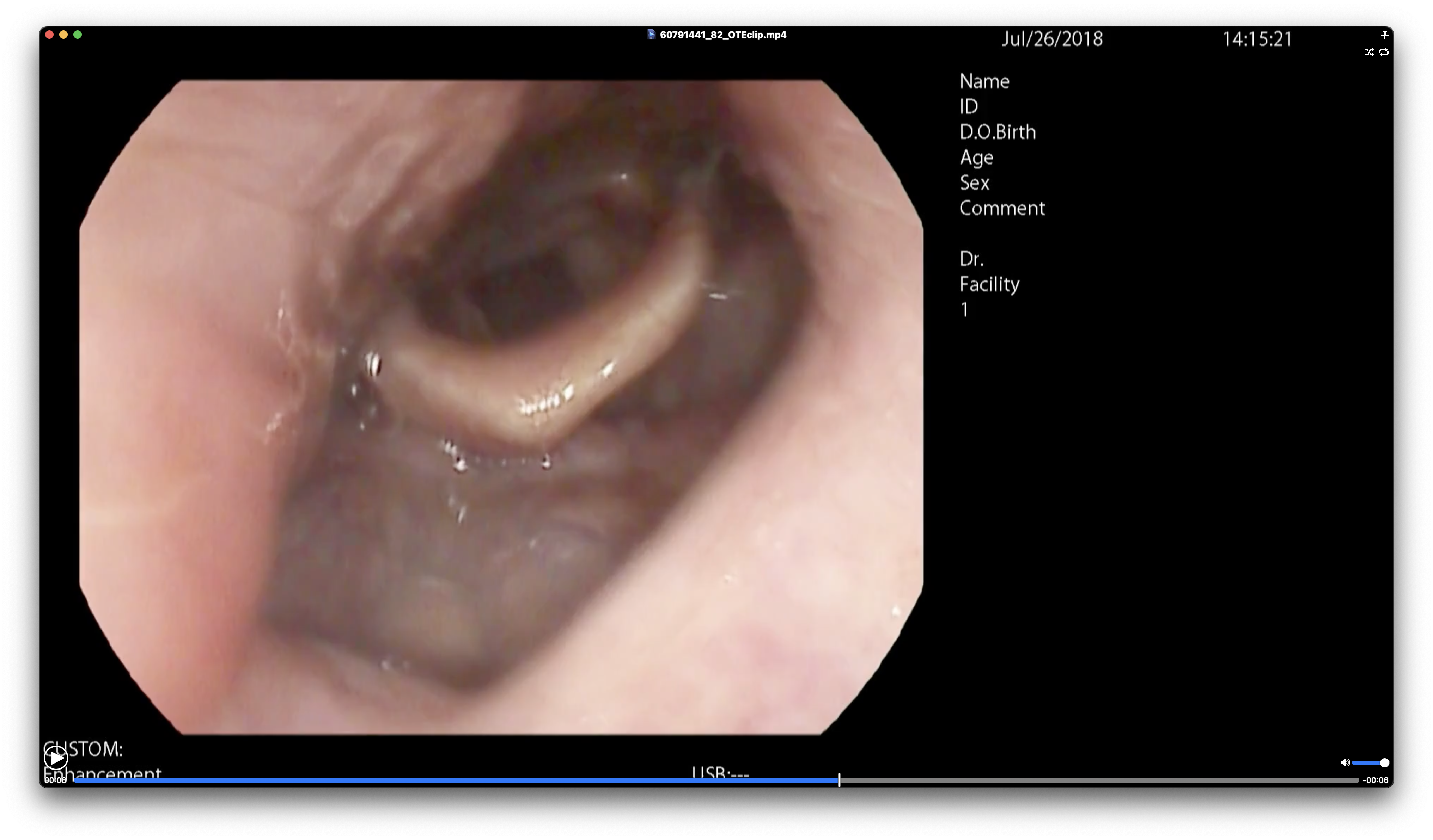 원천데이터 mp4 포맷