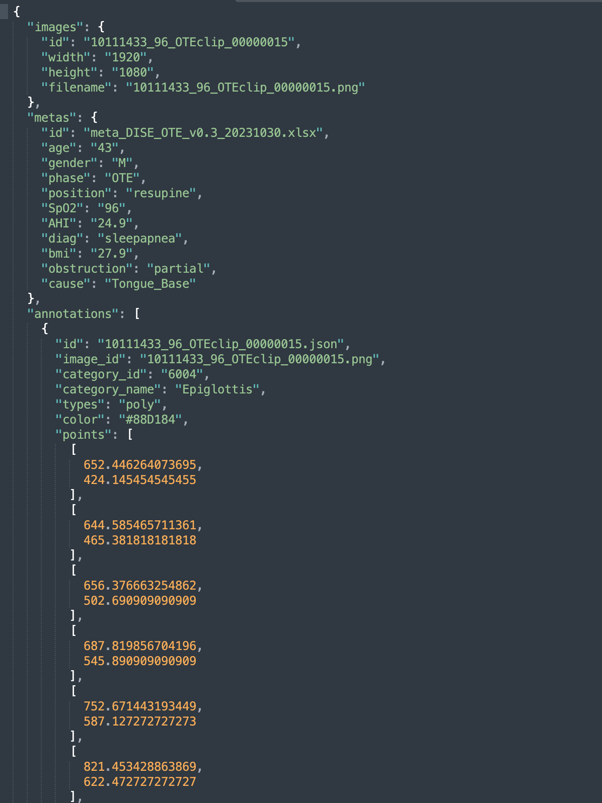 라벨링데이터 json 포맷