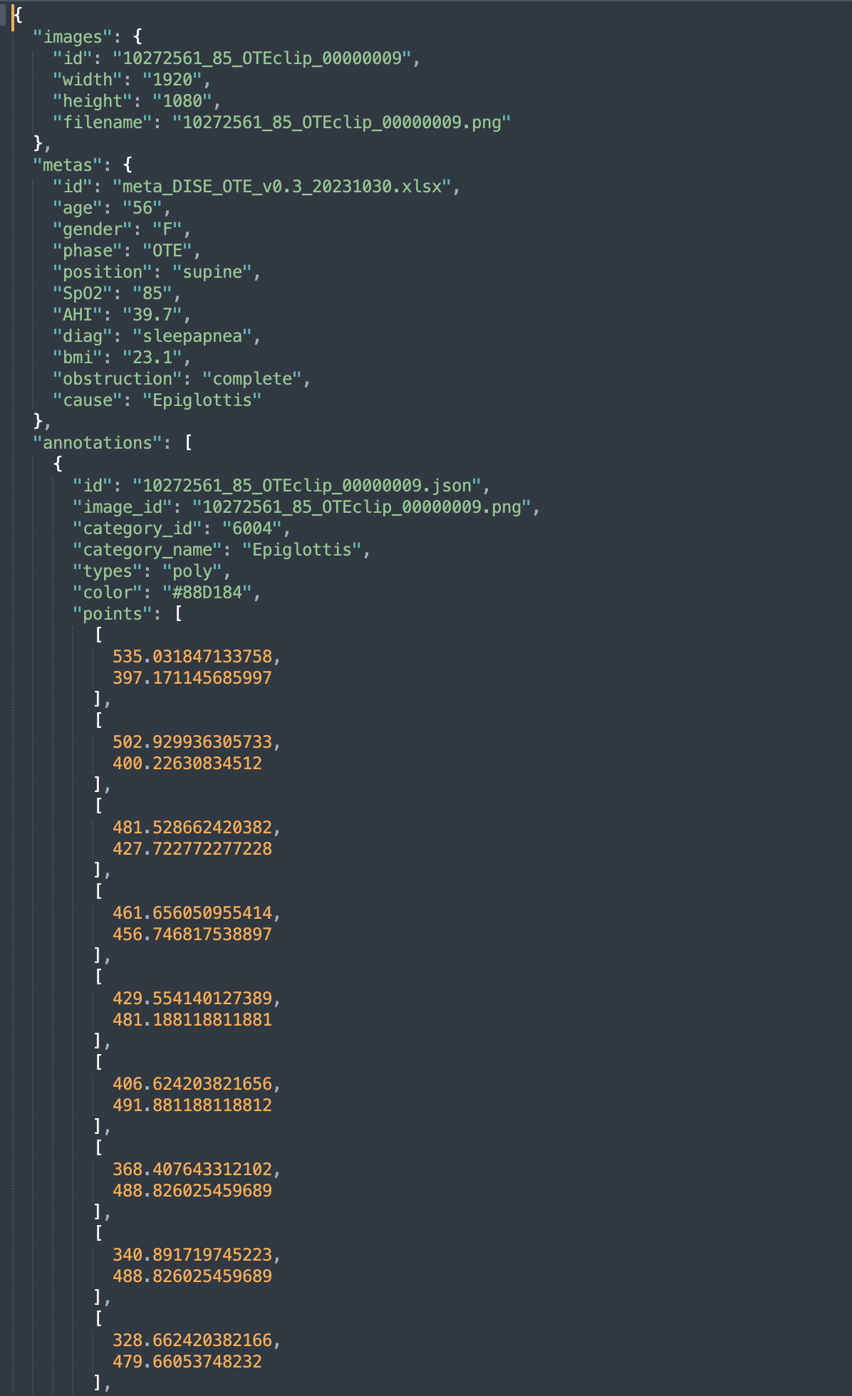 세부데이터 실제 예시