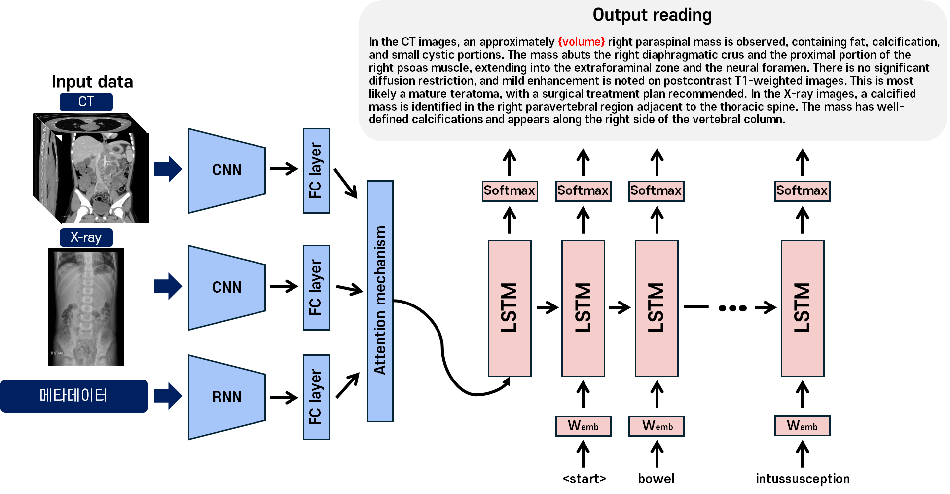 임무1: 소아 복부질환 영상 진단 분석 모델