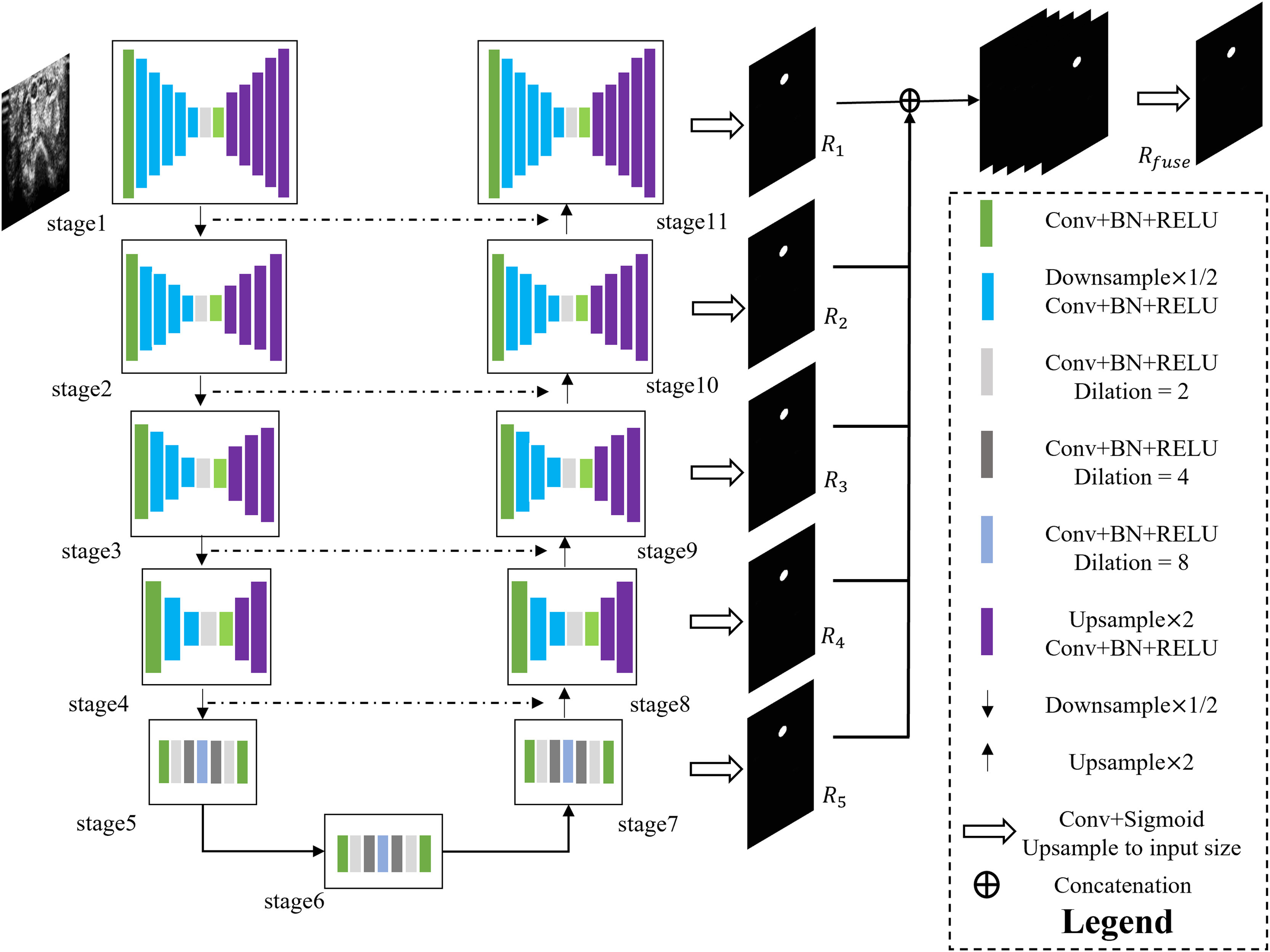 임무3: 소아 복부종괴 및 장확장 분할 모델(CT) (Semantic Segmentation)